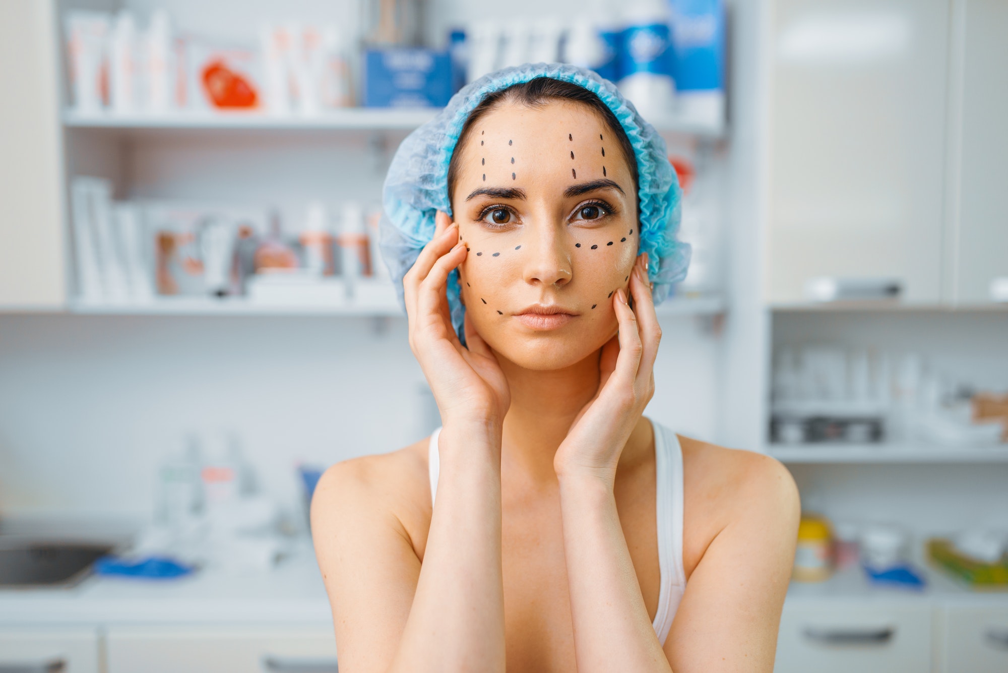 Patient with markers on face, preparation to botox