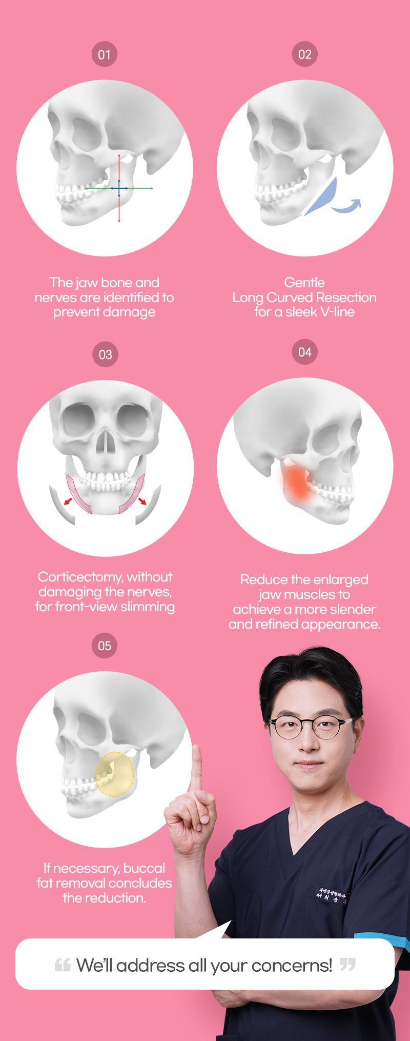 The different procedure performed with Square Jaw reduction