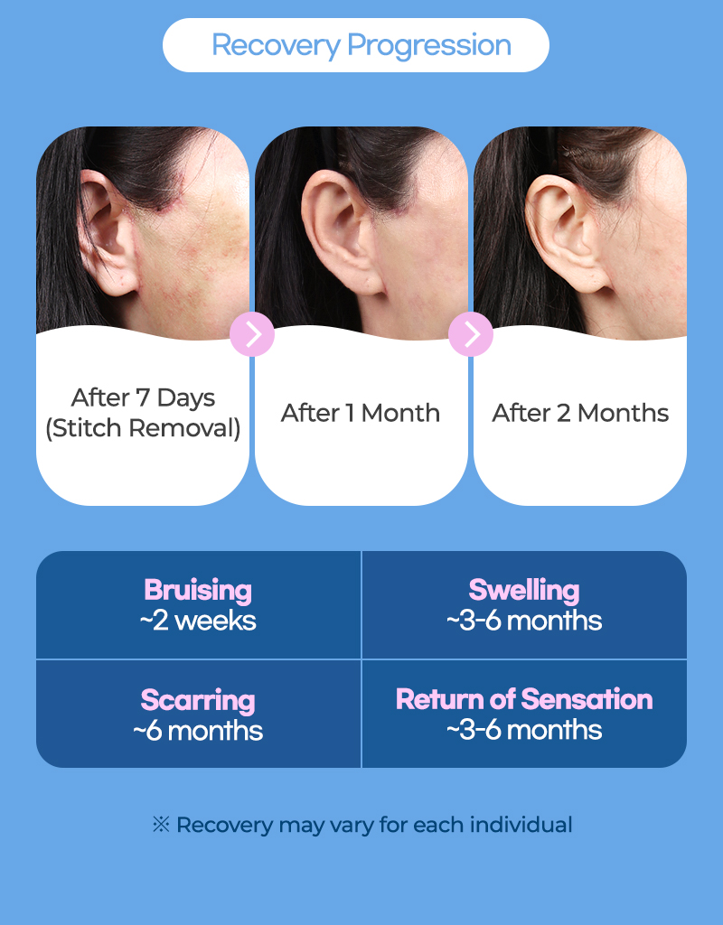 SMAS Facelift Recovery Scarring