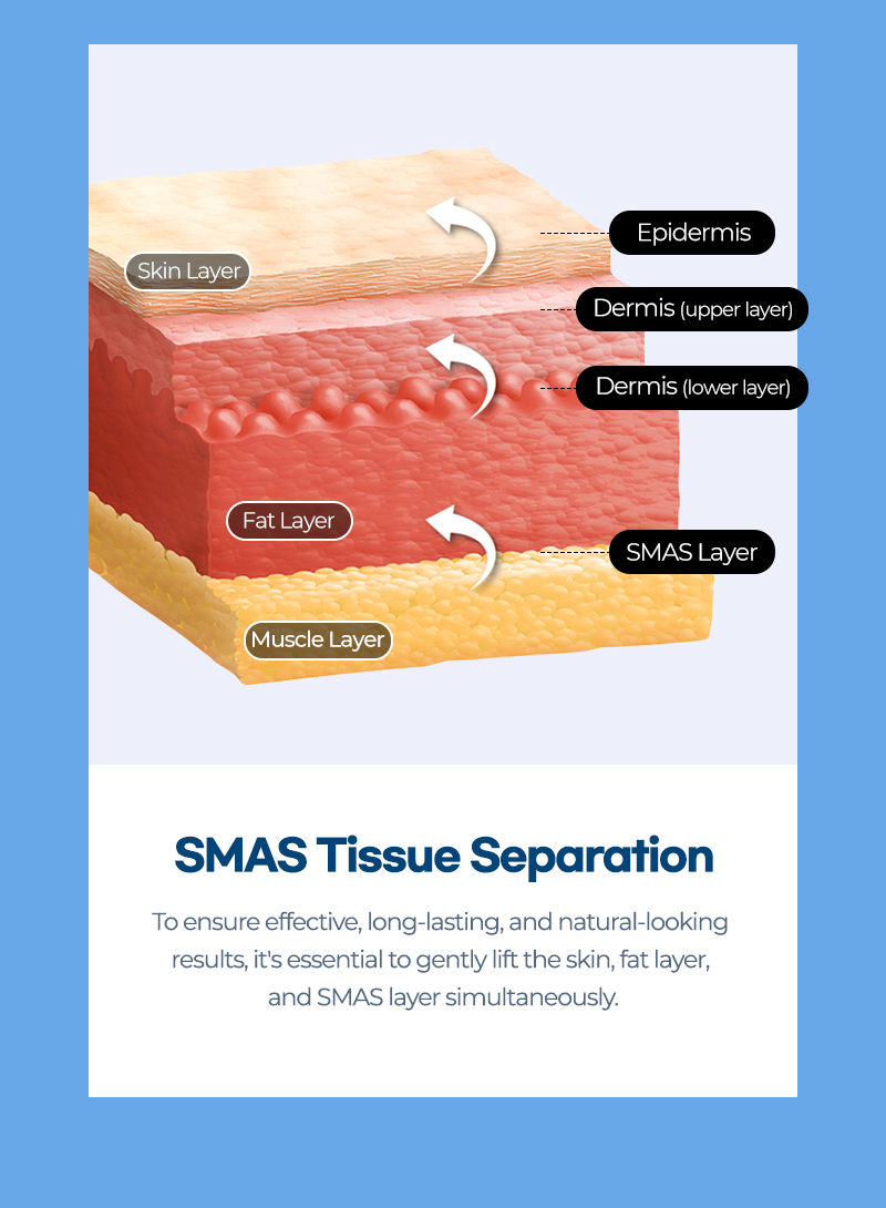 SMAS Facelift Rejuvenation Skin Tissue Seperation
