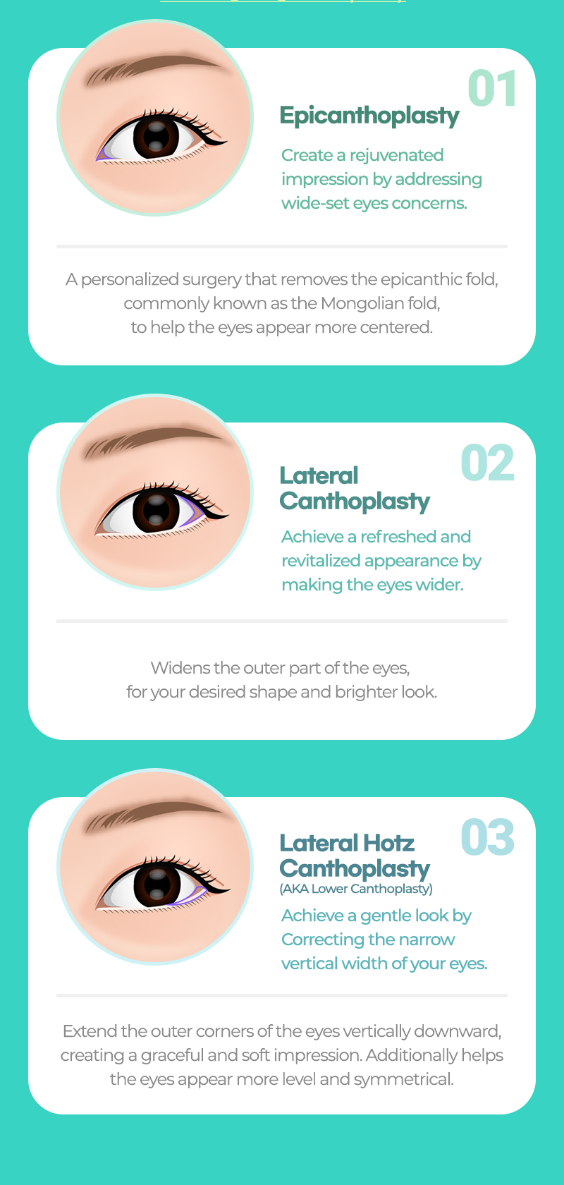 epicanthoplasty Lateral canthoplasty Lateral Hotz canthoplasty