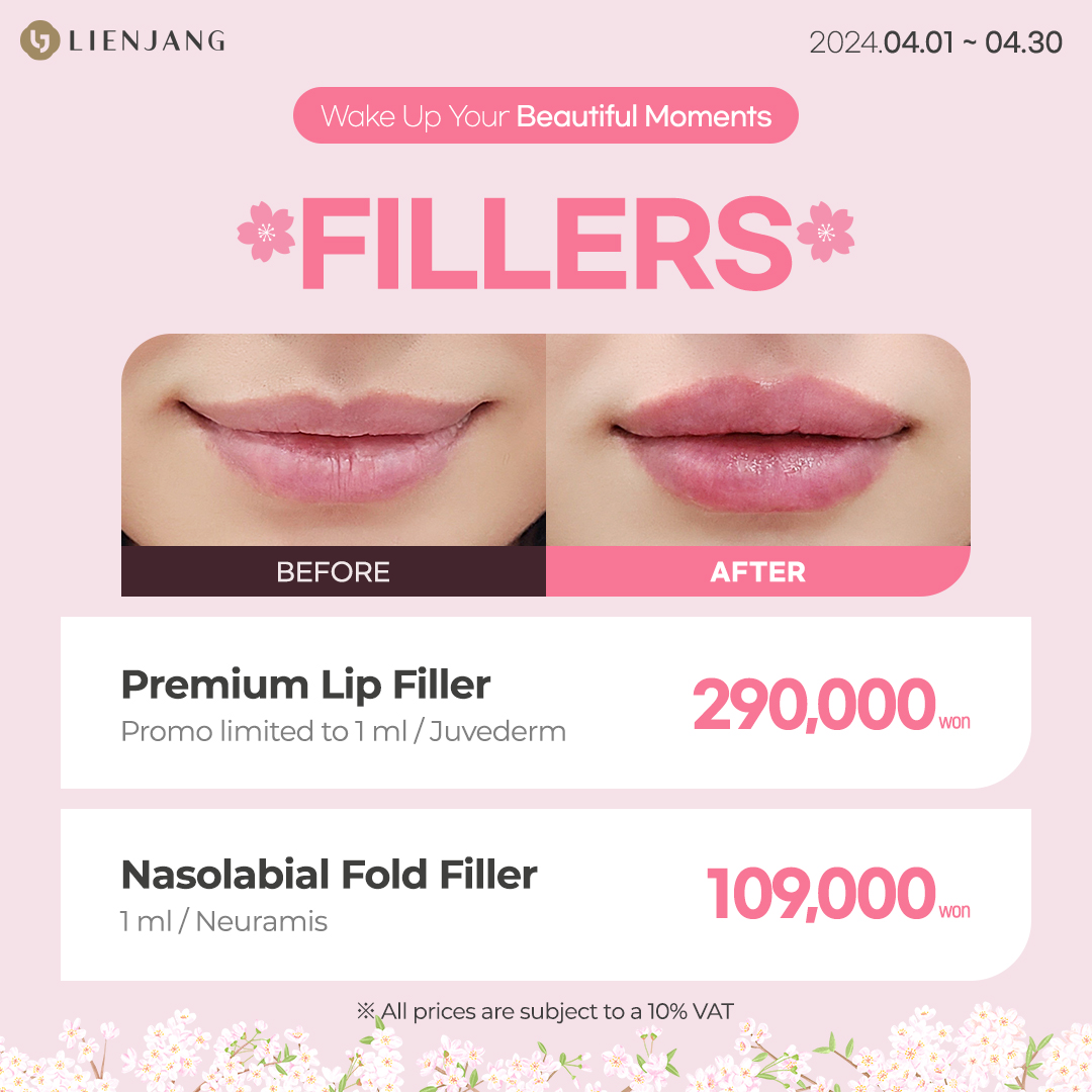 Spring sale on lip and smile line fillers including Juvederm and Neuramis at a premier beauty clinic in Seoul, Korea.