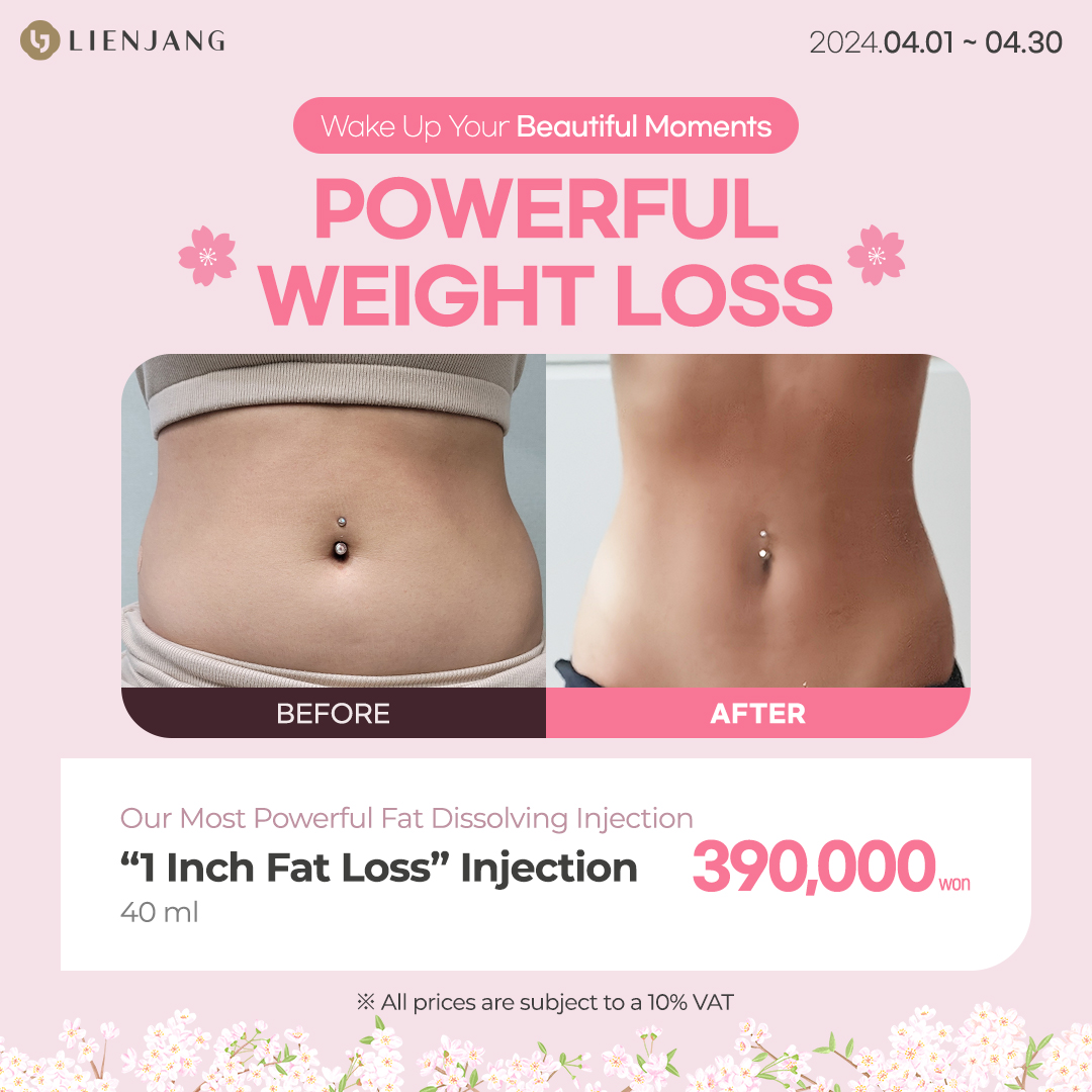 Spring promotion with fat dissolving injections at top beauty clinic in Seoul, Korea.