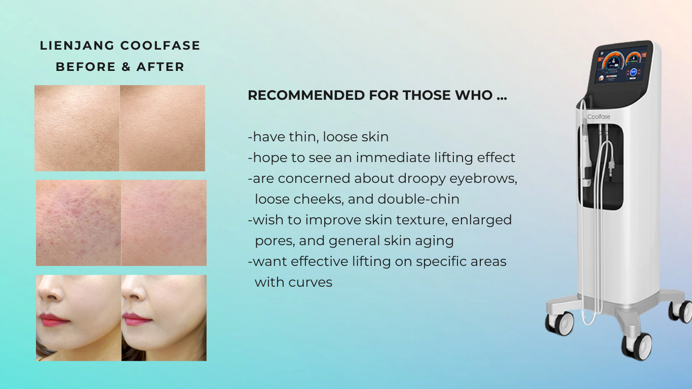 Check out before & after pictures of coolfase lifting. Coolfase is strongly recommended if you're concerned about loose skin, enlarged pores, and uneven skin texture.