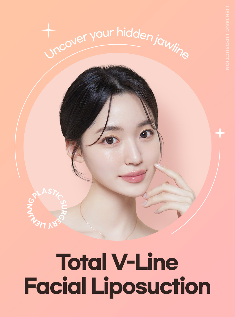 Total V-line facial liposuction at Lienjang, sculpting a defined jawline and chin for a slimmer, more youthful facial profile.
