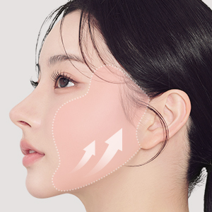 transformation from SMAS facelift surgery at Lienjang, achieving smooth, lifted skin