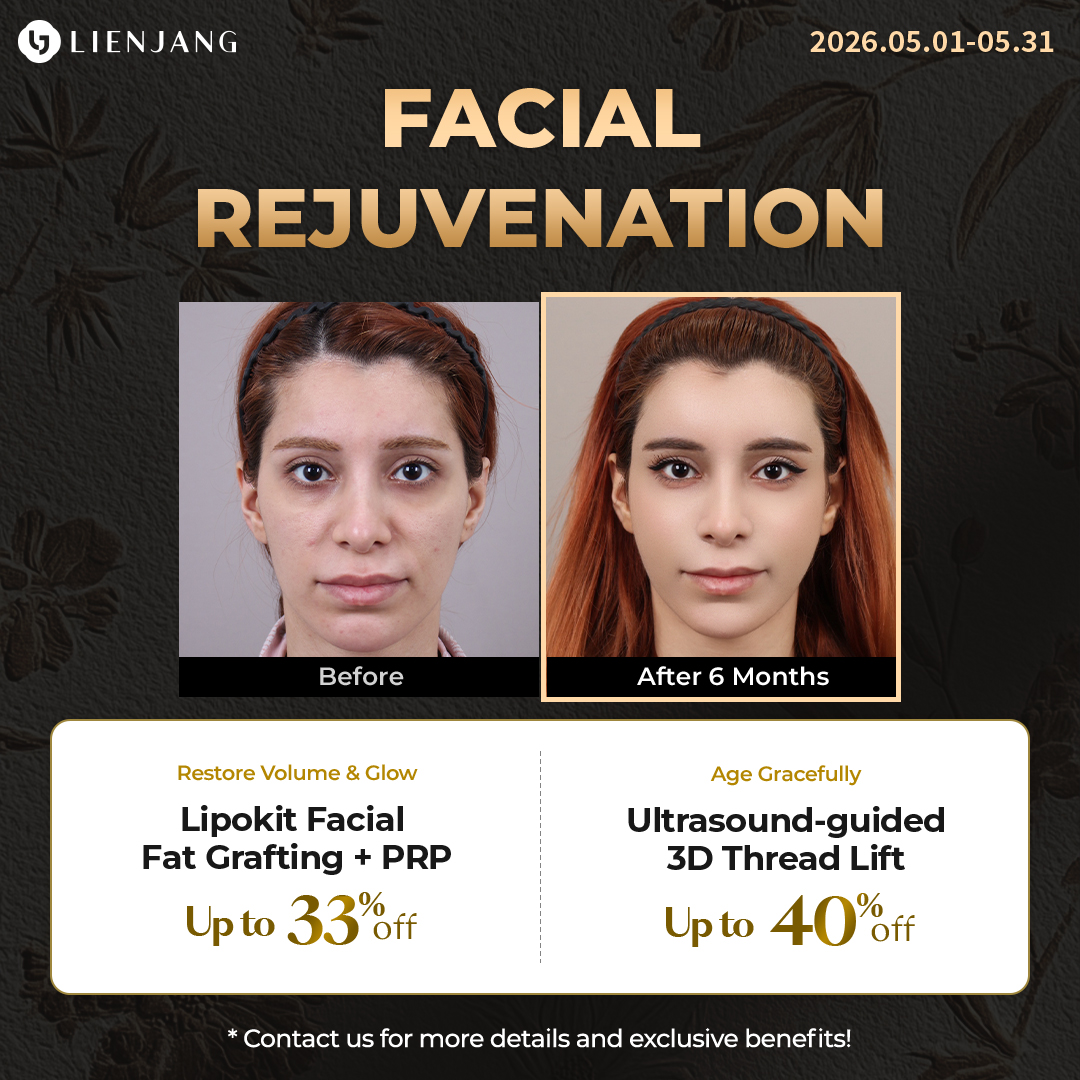 facelift surgery in seoul